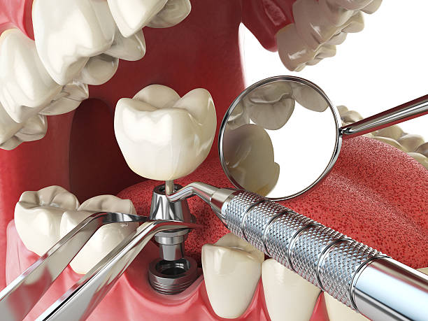 Best Emergency Dentist for Knocked-Out Tooth in Golden Valley, AZ